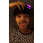 แก้มอ้วน